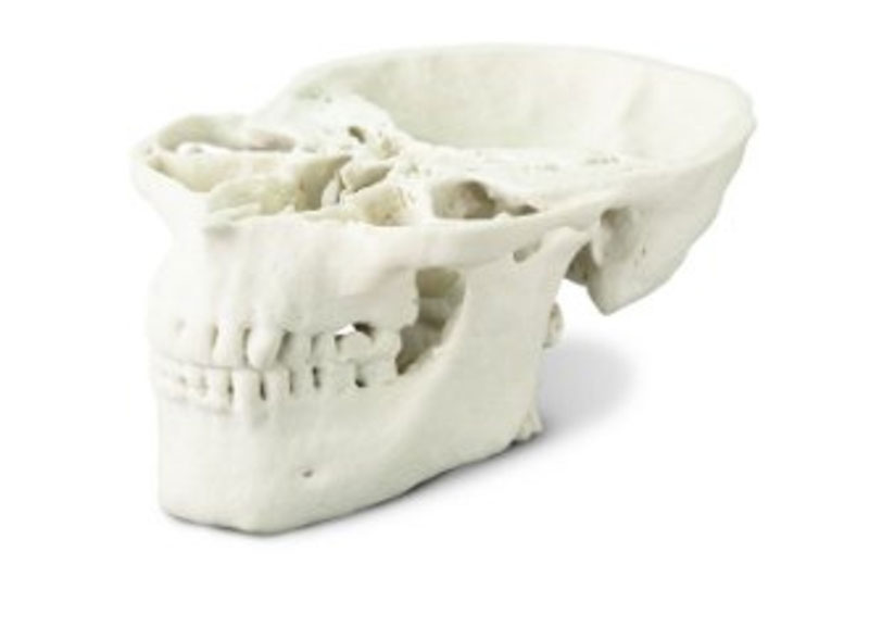 3D printing of a skull